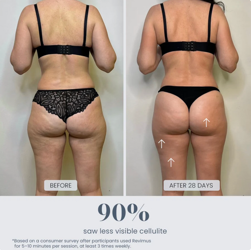 WellKure Cellulite Cupping Massager